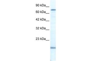 Western Blotting (WB) image for anti-PiggyBac Transposable Element Derived 3 (PGBD3) antibody (ABIN2461365) (PGBD3 Antikörper)