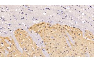 Immunohistochemistry (IHC) image for anti-Brain-Derived Neurotrophic Factor (BDNF) (AA 20-252) antibody (ABIN7430375)