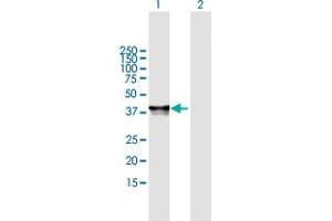 Western Blot analysis of PHF20L1 expression in transfected 293T cell line by PHF20L1 MaxPab polyclonal antibody. (PHF20L1 Antikörper  (AA 1-285))