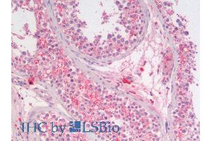 ABIN6391386 (5µg/ml) staining of paraffin embedded Human Testis. (SGTA Antikörper  (AA 84-97))