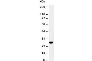 Western blot testing of Aquaporin 8 antibody and A431 cell lysate. (Aquaporin 8 Antikörper  (N-Term))
