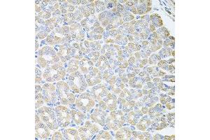 Immunohistochemistry of paraffin-embedded mouse stomach using SKAP2 antibody at dilution of 1:100 (x40 lens). (SKAP2 Antikörper)