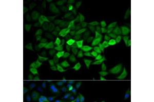 Immunofluorescence analysis of HeLa cells using UBE2C Polyclonal Antibody (UBE2C Antikörper)