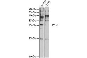 Western blot analysis of extracts of various cell lines, using PAEP antibody (ABIN6130606, ABIN6145168, ABIN6145170 and ABIN6221423) at 1:1000 dilution. (PAEP Antikörper  (AA 19-180))