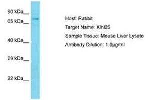 Image no. 1 for anti-Kelch-Like 26 (KLHL26) (AA 51-100) antibody (ABIN6750241) (KLHL26 Antikörper  (AA 51-100))