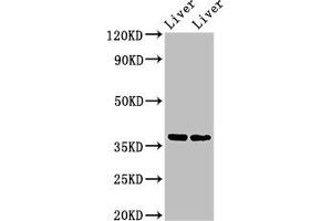 Western Blot Positive WB detected in: Mouse liver tissue, Rat liver tissue All lanes: CCNH antibody at 3 μg/mL Secondary Goat polyclonal to rabbit IgG at 1/50000 dilution Predicted band size: 38 kDa Observed band size: 38 kDa (Cyclin H Antikörper  (AA 261-319))