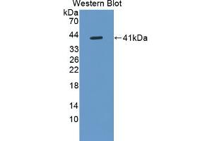 Detection of Recombinant DEFa6, Human using Polyclonal Antibody to Defensin Alpha 6, Paneth Cell Specific (DEFa6)