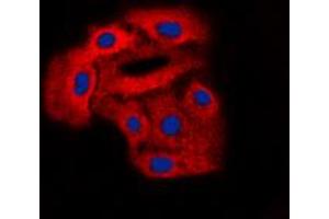 Immunofluorescent analysis of Arylsulfatase D staining in A549 cells. (Arylsulfatase D Antikörper  (Center))