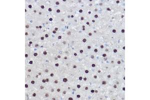 Immunohistochemistry of paraffin-embedded rat liver using EZH2/KMT6 Rabbit pAb (ABIN6133511, ABIN6140395, ABIN6140399 and ABIN6221414) at dilution of 1:100 (40x lens). (EZH2 Antikörper  (AA 1-250))