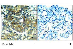 Image no. 1 for anti-Ribosomal Protein S6 Kinase, 70kDa, Polypeptide 1 (RPS6KB1) (pSer411) antibody (ABIN197035) (RPS6KB1 Antikörper  (pSer411))