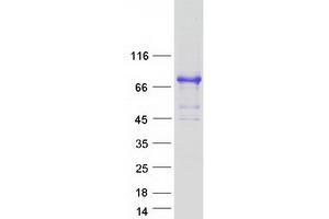 Western Blotting (WB) image for LIM Domains Containing 1 (LIMD1) protein (Myc-DYKDDDDK Tag) (ABIN2724731)
