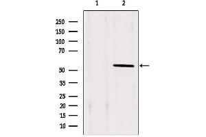 Western blot analysis of extracts from Hela, using PAX1 Antibody. (PAX1 Antikörper  (Internal Region))