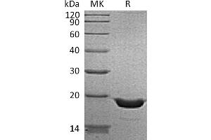 SDS-PAGE (SDS) image for Tumor Necrosis Factor alpha (TNF alpha) protein (His tag) (ABIN7455630)