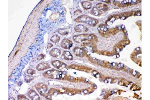 Immunohistochemistry (IHC) image for anti-Matrix Metallopeptidase 13 (Collagenase 3) (MMP13) (AA 99-335) antibody (ABIN5693125)
