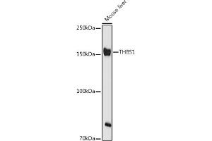 Western Blotting (WB) image for anti-Thrombospondin 1 (THBS1) (AA 80-360) antibody (ABIN3022979)
