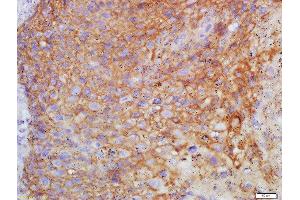 Formalin-fixed and paraffin embedded human endometrium labeled with Anti-FSH/FSHB Polyclonal Antibody, Unconjugated  at 1:200 followed by conjugation to the secondary antibody and DAB staining (FSHB Antikörper  (AA 61-98))