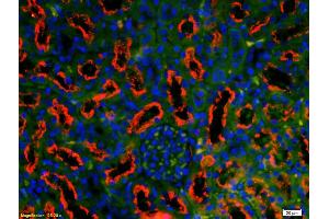 anti-Fx1a antibody