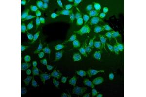 IF analysis of PDIA5 using anti-PDIA5 antibody (ABIN7601801). (PDIA5 Antikörper  (AA 46-481))