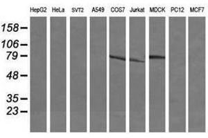Image no. 5 for anti-Differentially Expressed in FDCP 6 Homolog (DEF6) antibody (ABIN1497809) (DEF6 Antikörper)