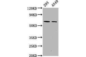 Western Blot Positive WB detected in 293 whole cell lysate 65549 whole cell lysate All lanes Phospho-PRKAA2 antibody at 1. (Rekombinanter PRKAA2 Antikörper  (pSer491))