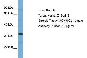 Host: Rabbit Target Name: C12ORF49 Sample Tissue: Human ACHN Whole Cell Antibody Dilution: 1ug/ml (C12orf49 Antikörper  (N-Term))