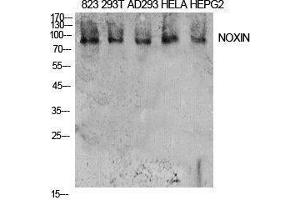 Western Blotting (WB) image for anti-Chromosome 11 Open Reading Frame 82 (C11orf82) (Internal Region) antibody (ABIN3181418) (C11orf82 Antikörper  (Internal Region))