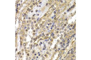 Immunohistochemistry of paraffin-embedded rat kidney using NEDD9 antibody (ABIN1873870) at dilution of 1:200 (40x lens). (NEDD9 Antikörper)