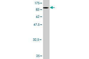 Western Blotting (WB) image for anti-Lymphocyte-Specific Protein tyrosine Kinase (LCK) (AA 1-539) antibody (ABIN561649)