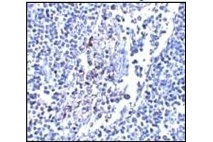 Immunohistochemistry (IHC) image for anti-Interleukin 33 (IL33) antibody (ABIN492540)