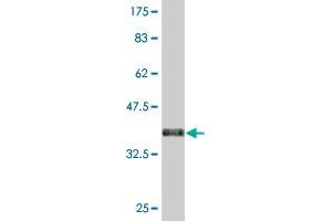 Western Blotting (WB) image for anti-Major Histocompatibility Complex, Class II, DQ alpha 1 (HLA-DQA1) (AA 24-110) antibody (ABIN516498)