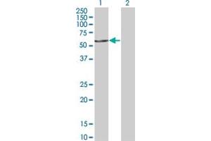 Western Blot analysis of FASTK expression in transfected 293T cell line by FASTK monoclonal antibody (M02), clone 2B7. (FASTK Antikörper  (AA 67-154))