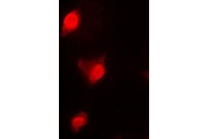 Immunofluorescent analysis of Cyclin B1 staining in K562 cells. (Cyclin B1 Antikörper  (Center))