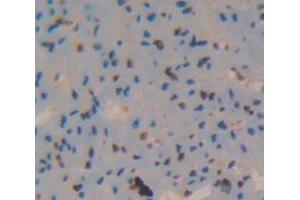 Immunohistochemistry (IHC) image for anti-ATPase, Na+/K+ Transporting, beta 4 Polypeptide (ATP1B4) (AA 132-356) antibody (ABIN1866821)