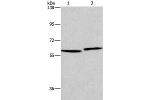 Western Blot analysis of Human testis and prostate tissue using HAS1 Polyclonal Antibody at dilution of 1:350 (HAS1 Antikörper)