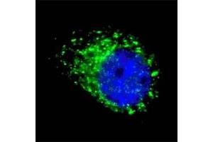Fluorescent image of chloroquine treated U251 cells stained with MAP1LC3A antibody (1:100).