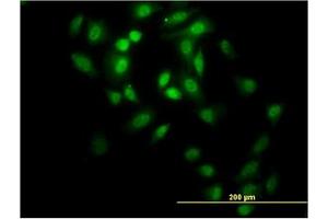Image no. 3 for anti-GA Binding Protein Transcription Factor, alpha Subunit 60kDa (GABPA) (AA 1-101) antibody (ABIN598706) (GABPA Antikörper  (AA 1-101))