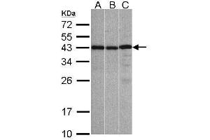 WB Image Sample(30 ug whole cell lysate) A:A431, B:Hep G2 , C:Raji , 12% SDS PAGE antibody diluted at 1:1000 (ZC3H8 Antikörper)