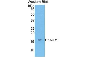 Western blot analysis of the recombinant protein. (CXCL9 Antikörper  (AA 23-125))
