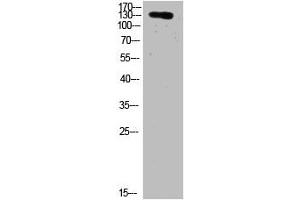 Western Blot analysis of HELA cells using primary antibody diluted at 1:2000(4 °C overnight). (COL19A1 Antikörper  (AA 161-210))
