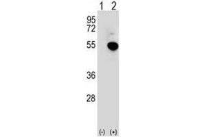 Western blot analysis of IRF4 antibody and 293 cell lysate (2 ug/lane) either nontransfected (Lane 1) or transiently transfected (2) with the IRF4 gene. (IRF4 Antikörper  (AA 164-191))