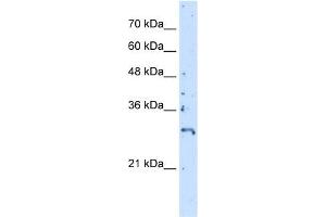 WB Suggested Anti-CREBZF Antibody Titration:  5. (CREBZF Antikörper  (C-Term))