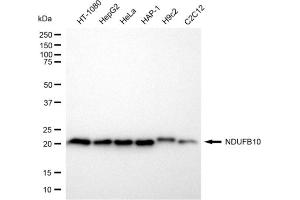 Western blotting analysis using NDUFB10 antibody (ABIN7799546). (NDUFB10 Antikörper)