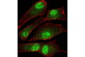 Fluorescent image of U-87 MG cells stained with MORC2 Antibody (C-term) (ABIN1944761 and ABIN2838553). (MORC2 Antikörper  (C-Term))