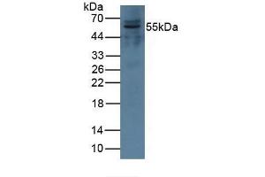 Detection of CFI in Porcine Kidney Tissue using Polyclonal Antibody to Complement Factor I (CFI) (Complement Factor I Antikörper  (AA 28-243))