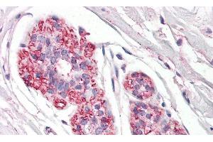 Detection of PDPN in Human Breast Tissue using Polyclonal Antibody to Podoplanin (PDPN) (Podoplanin Antikörper  (AA 23-143))
