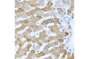 Immunohistochemistry of paraffin-embedded human liver using IFIT3 antibody (ABIN1680389, ABIN3018293, ABIN3018295 and ABIN6220427) at dilution of 1:100 (40x lens). (IFIT3 Antikörper  (AA 128-331))
