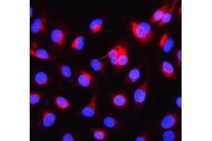 IF analysis of Alpha Internexin using anti-Alpha Internexin antibody (ABIN4886634). (INA Antikörper  (AA 71-161))