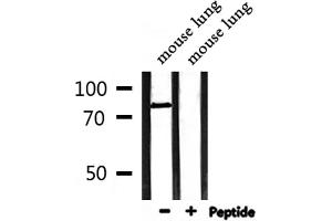 Western blot analysis of extracts from mouse lung, using MLH1 Antibody. (MLH1 Antikörper  (Internal Region))