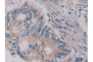 Immunohistochemistry (IHC) image for anti-Jagged 2 (JAG2) (AA 714-981) antibody (ABIN7439534)