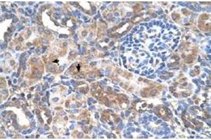 Immunohistochemical staining (Formalin-fixed paraffin-embedded sections) of human kidney with GALNT6 polyclonal antibody  at 4-8 ug/mL working concentration. (GALNT6 Antikörper  (N-Term))